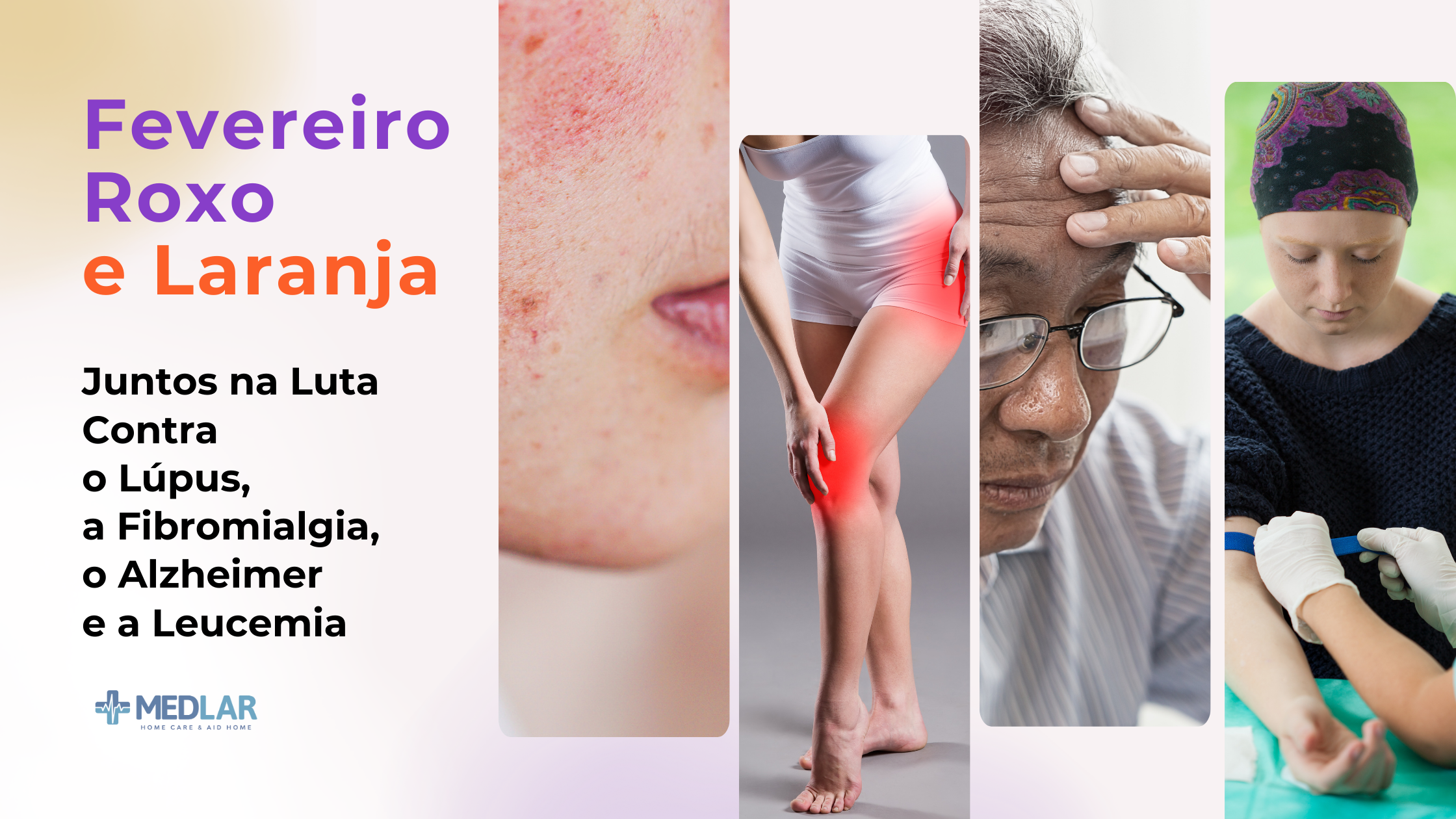 Fevereiro Roxo e Laranja: informação e apoio na luta contra Lúpus, Fibromialgia, Alzheimer e Leucemia